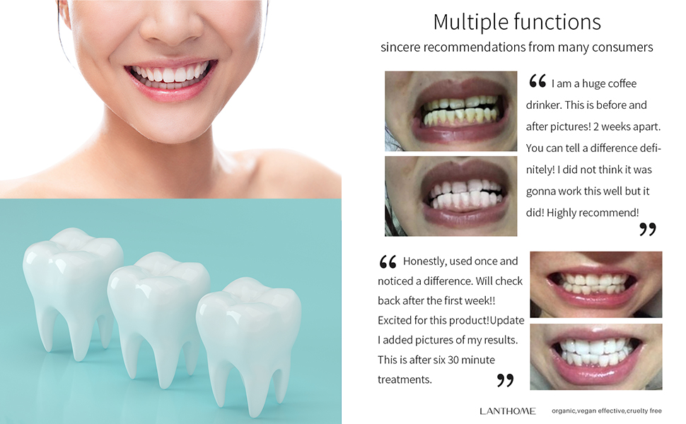 deep cleaning teeth mousse