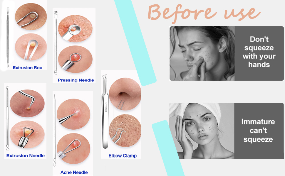 blackhead remover tools
