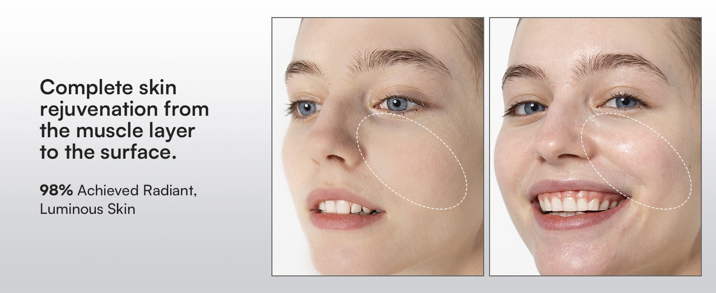 Red Light Therapy for Face