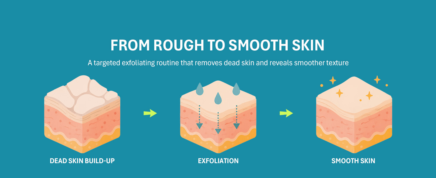 Heel mask formulated to soften rough calluses