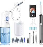 Ear Wax Removal - Ear Cleaner - Ear Camera - Ear Wax Removal Kit - Ear Wax Removal Tool Camera - ...