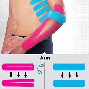 arm
