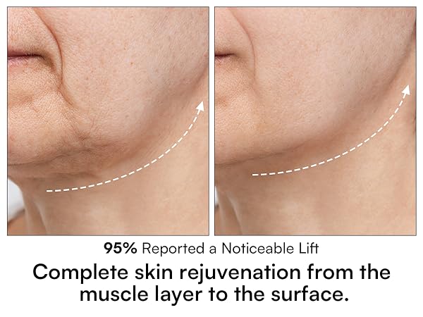 Red Light Therapy for Face