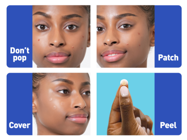 mighty patch pimple patch hero pimple patch