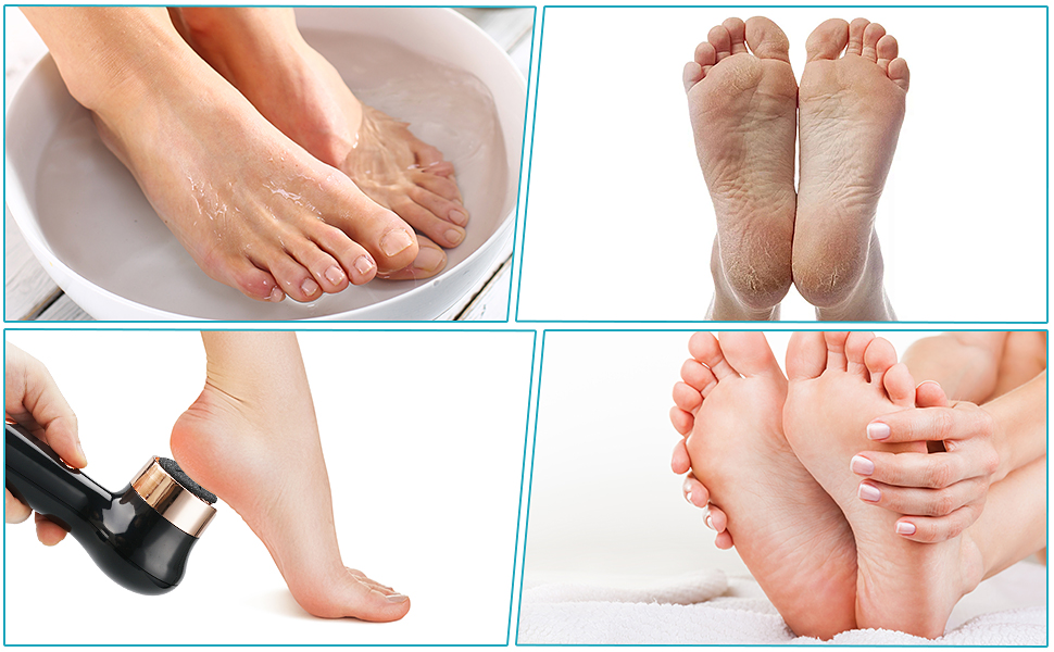 foot shaver electric