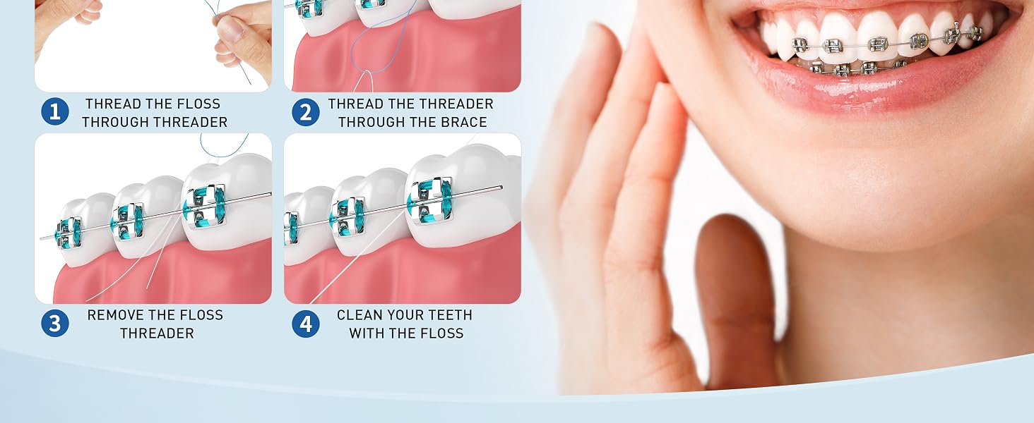 dental bridge floss threaders