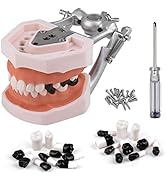 Ultrassist Typodont Teeth Model Includes 20pcs of Special Black Replacement Teeth, Dental Typodon...