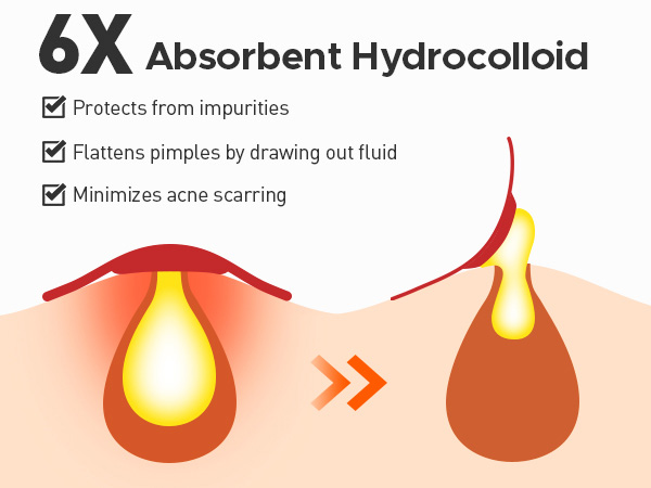 6X Absorbent Hydrocolloid