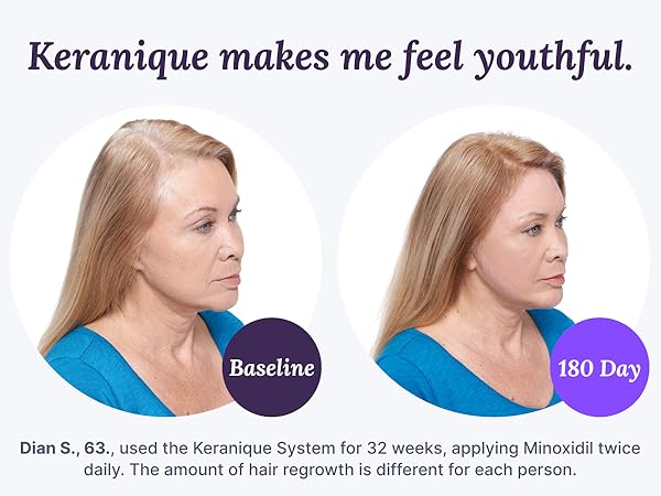 Keranique Scalp Massager Silicone Head Scrubber Hair Growth Stimulator Shower Massage Stress Relax.