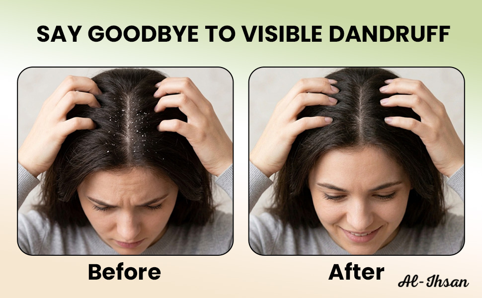 Dandruff Free