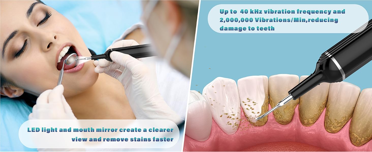 tooth cleaning kit