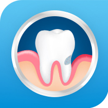 Gum Recession