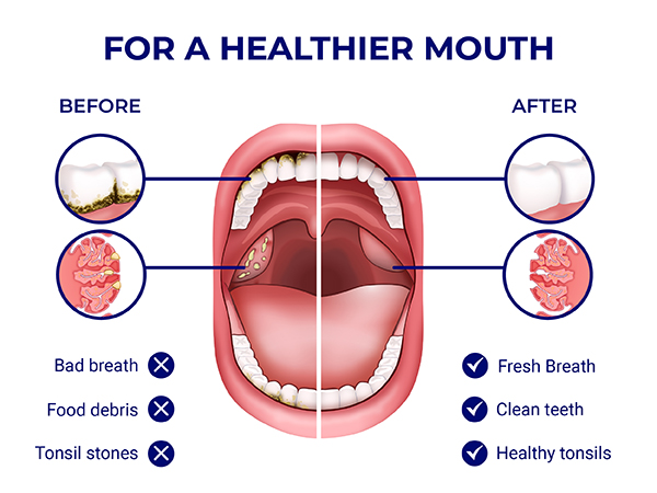 for a healthier mouth