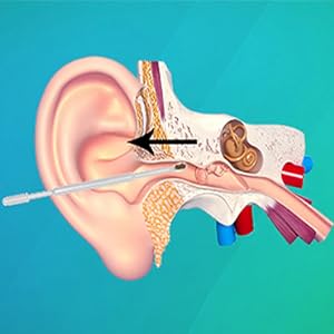 ear cleaner