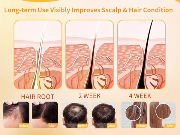 hair growth shampoo bar ginger native shampoo herbal essences shampoo travel shampoo for oily hair