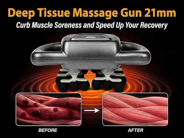 21mm Deep Tissue
