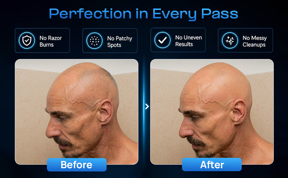 no razor burns no spots