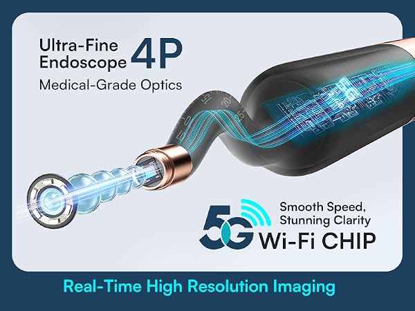 2OMP ultra-clear camera and 5G video transmission
