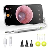 Digital Otoscope with Gyroscope, AnyScope HD Ear Camera with Ear Wax Removal Tools, Video Ear Sco...