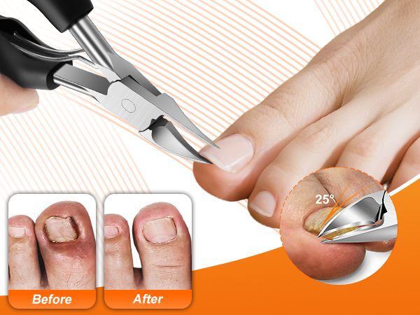 Toenail Clippers for Seniors Ingrown Thick Toenails