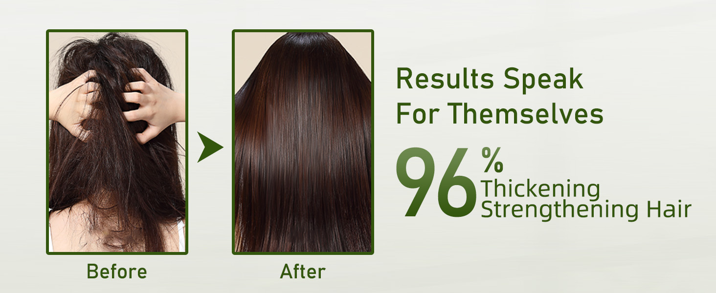 Rosemary Shampoo for Hair Growth