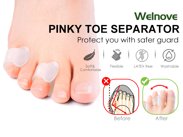 Pinky Toe Spacers