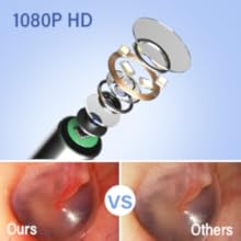 ear wax removal tool camera ear camera earwax cleaner cleaning Otoscope Ear Scoop Earwax removal kit