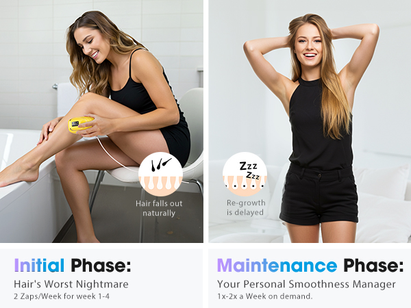 laser hair removal for women