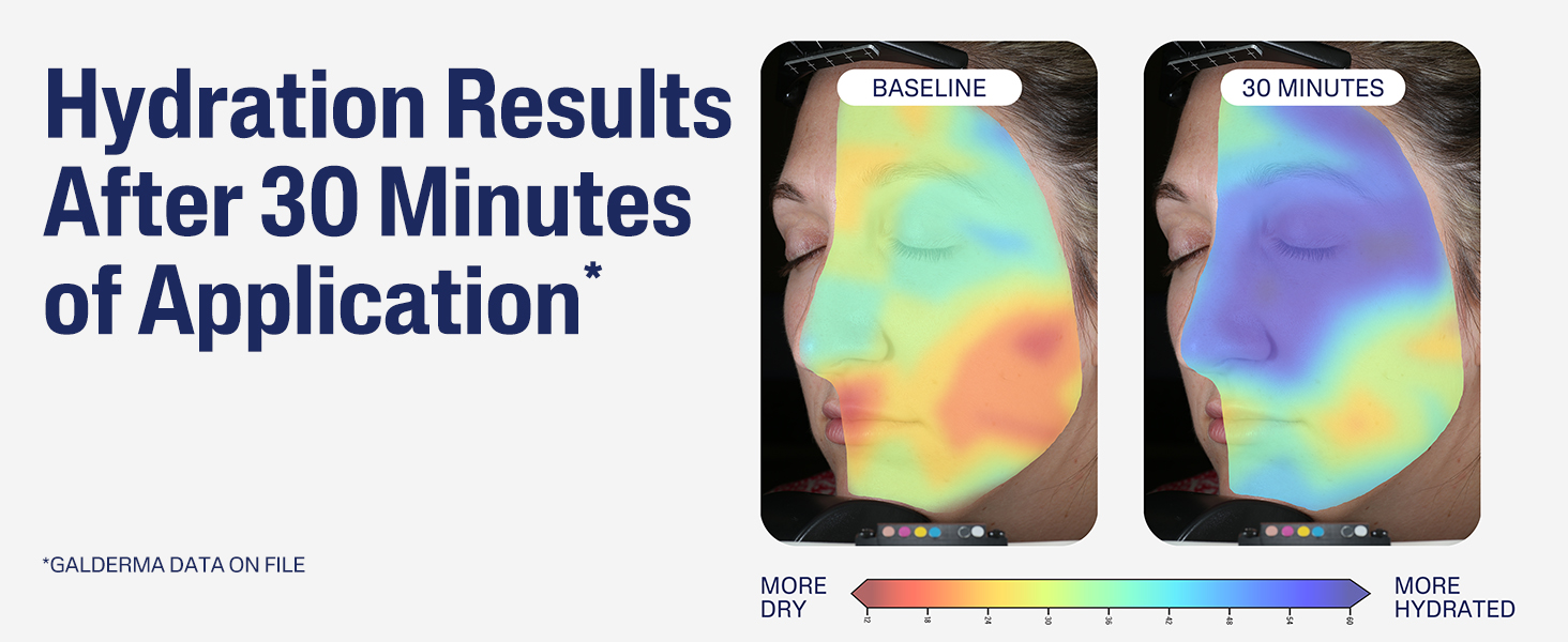 Hydration Results