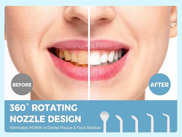 cordless water flosser