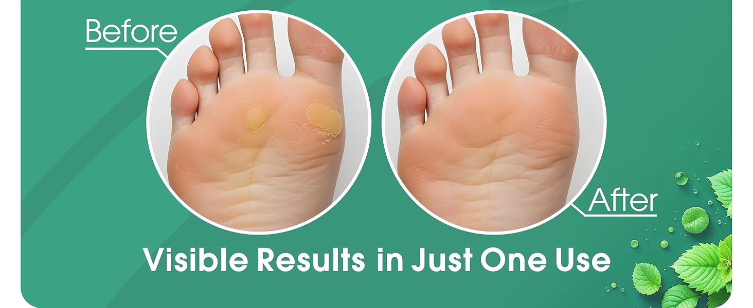 foot scrubber callus remover for feet pedicure tools for feet foot spa cuticle remover