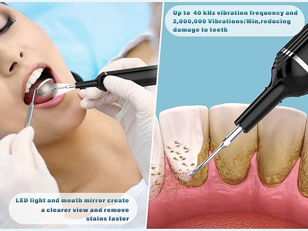 dental cleaner