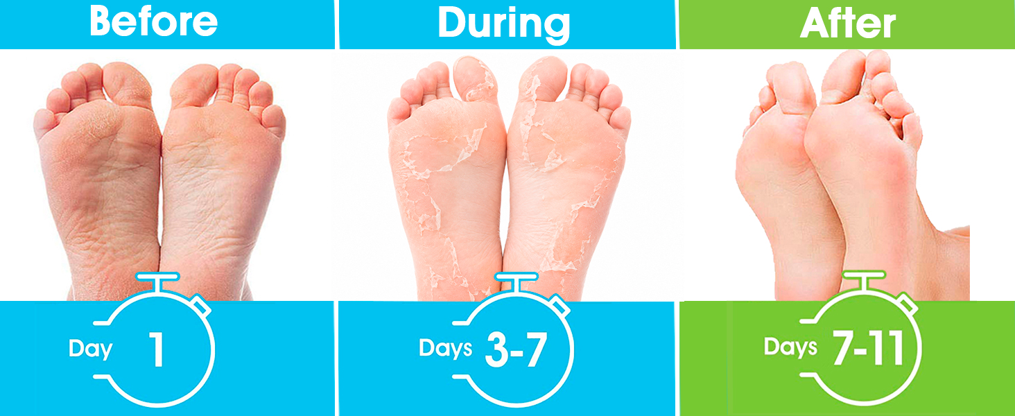foot mask