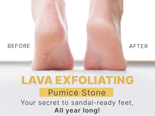 pumice stone feet heavy callused hand callus remover pumustone pumas scrubber piedra pomez pies