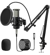 ALABS XLR Condenser Microphone, Professional Cardioid Recording Microphone Kit with 25mm Diaphrag...