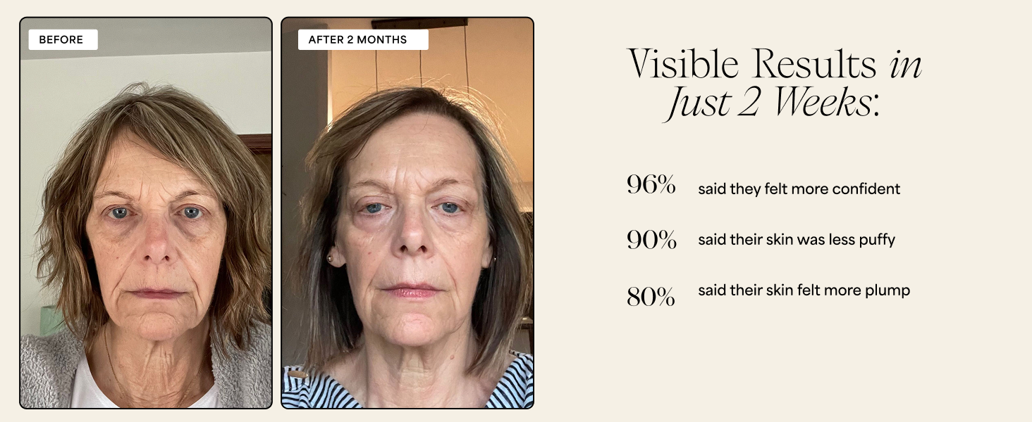Visible Results in Just 2 Weeks