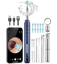 https://m.media-amazon.com/images/S/aplus-media-library-service-media/948e5436-4302-49d4-acf9-8eb3a066c0a3.__AC_SR200,225___.jpg