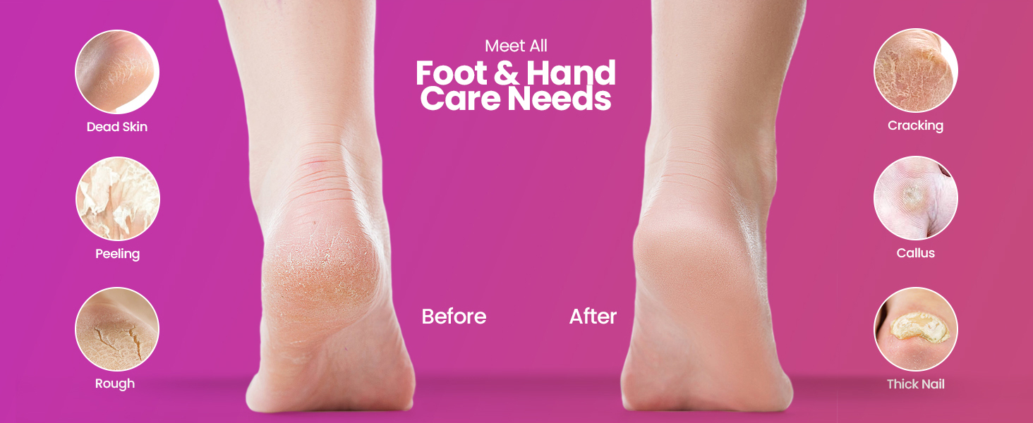 electric foot file