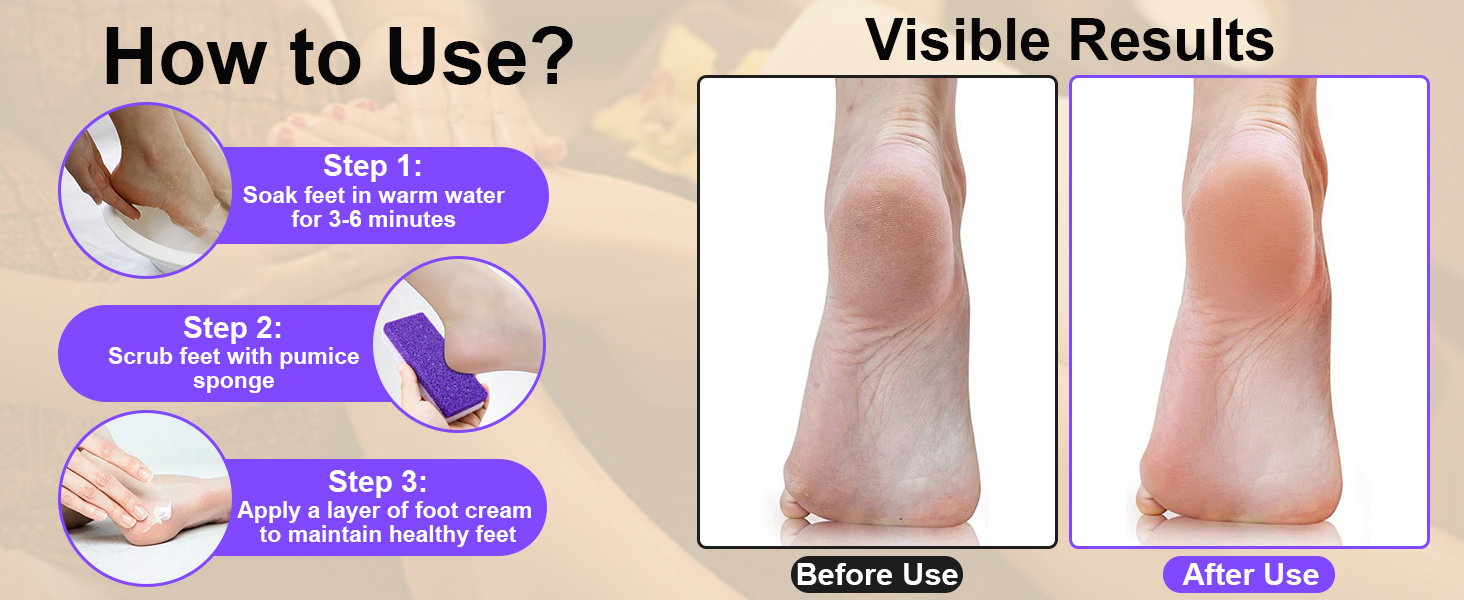 Dead Skin Remover