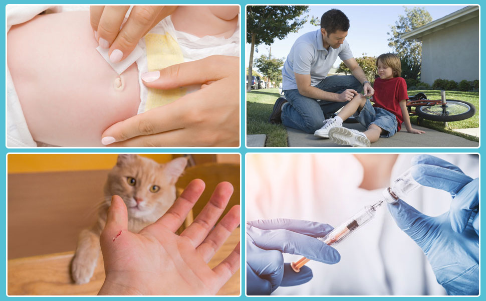 medical iodine for wounds