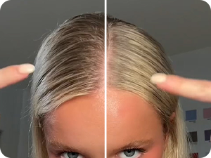 HLP for blondes