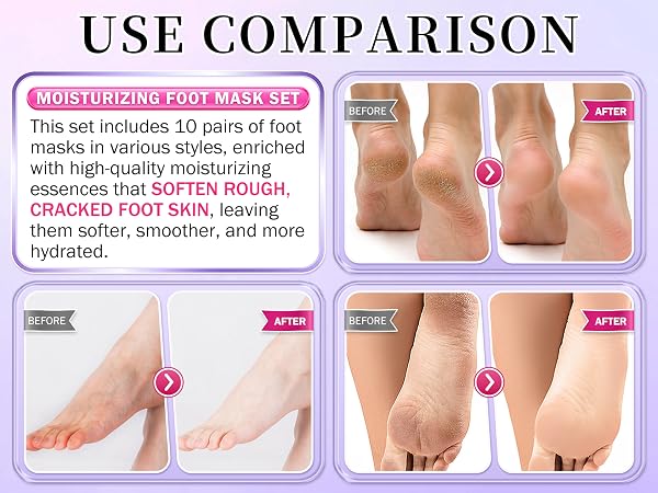 foot masks foot mask for dry cracked feet foot peeling mask moisturizing foot mask feet peeling mask