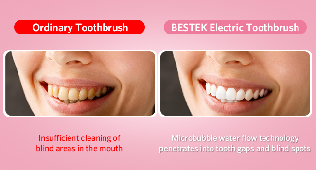 Electric Toothbrush