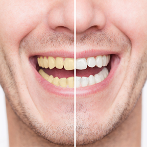 Our unique formula is designed for double the whitening action.