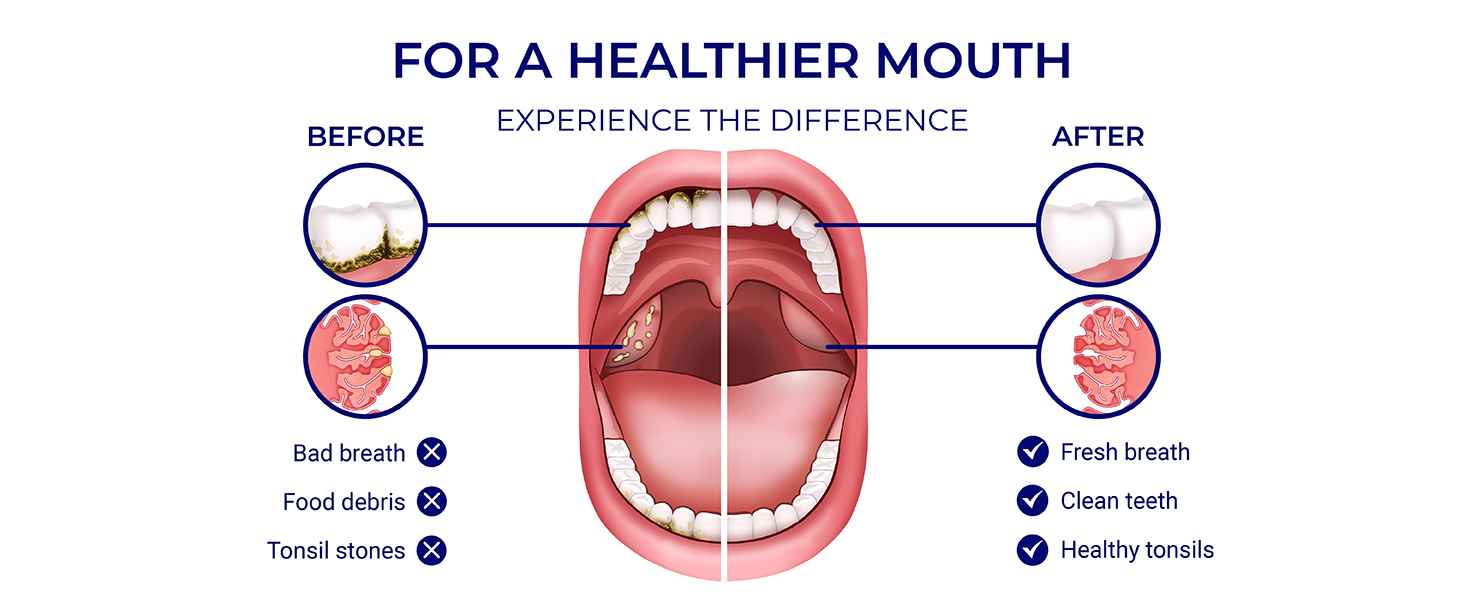 for a healthier mouth