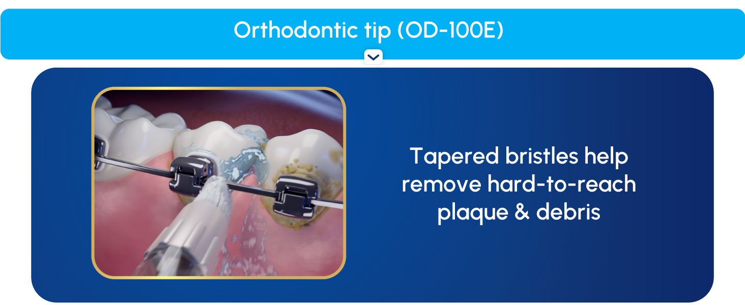 Image of Orthodontic Flossing tip with text reading tapered bristles to remove hard to reach plaque.