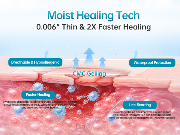 Moist Healing
