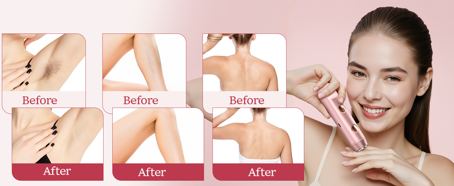 women's bikini shaver