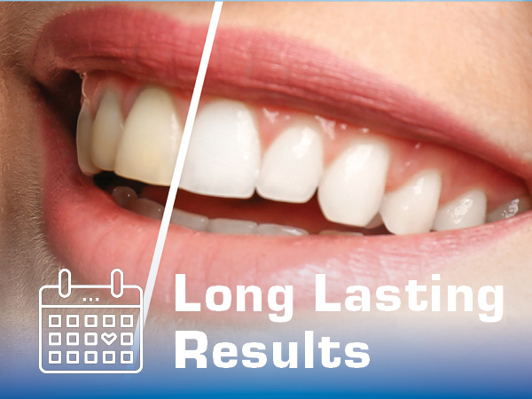 get long lasting results from plus white speed whitening gel for yellow teeth stains