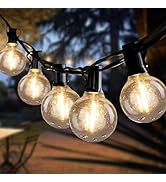 Lemontec LED String Lights, 25FT Backyard Patio String Light with 25 Clear Globe Bulbs-UL Listed ...